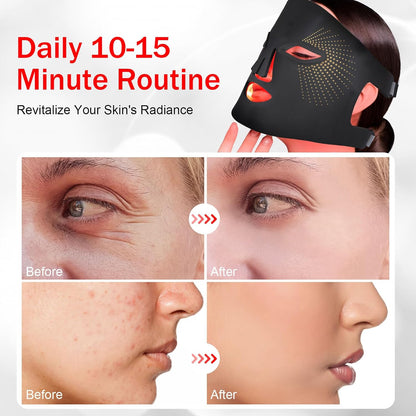 Red Light Therapy for Face, Red Light Therapy Mask, 3 Colors LED Facial Mask for Wrinkle Remove & anti Aging, Skin Care Home Use,Black